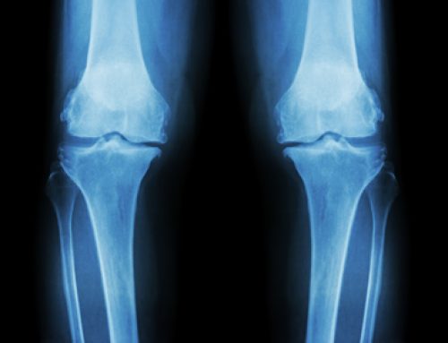 PRP & Knee Osteoarthritis
